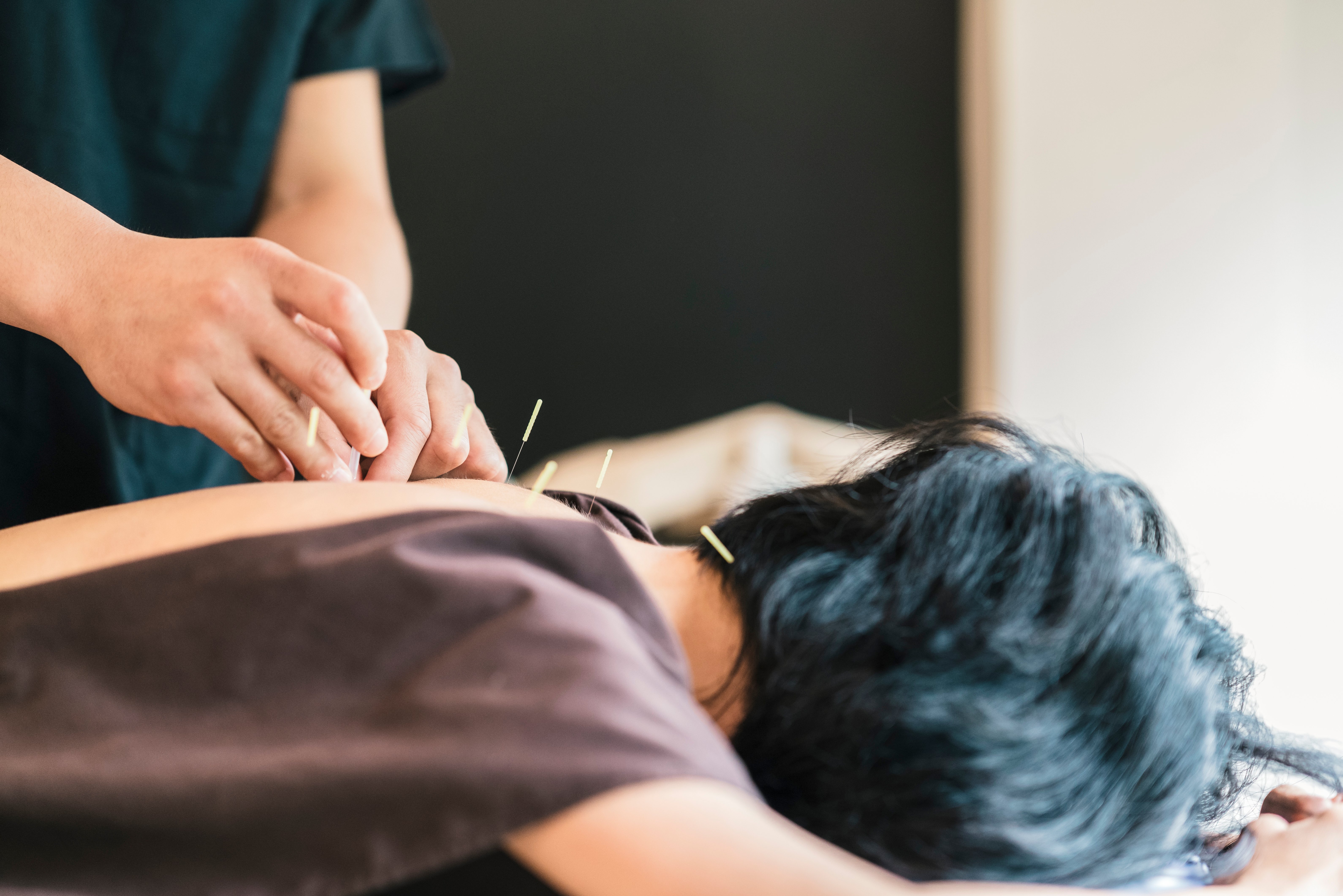 woman-receiving-acupuncture-treatment-from-an-acup-2026-01-05-00-37-25-utc